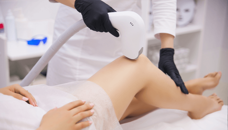 Epilation par lumière intense pulsée : des risques ?