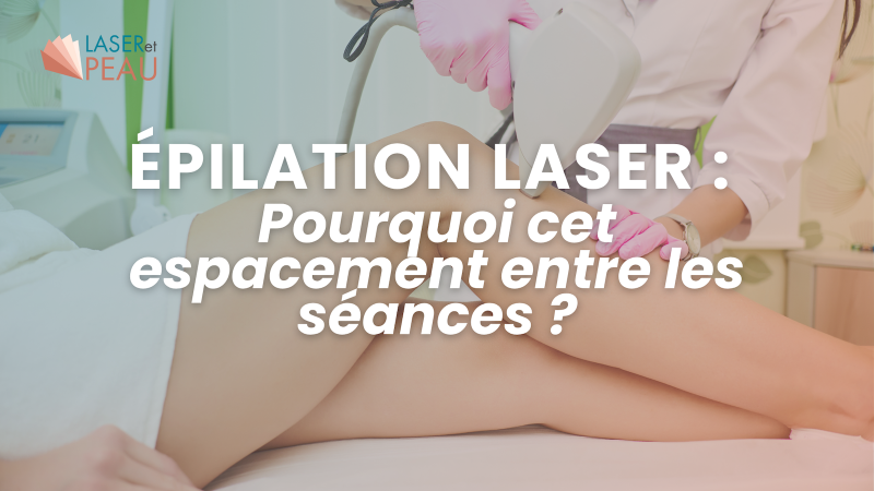 Épilation laser : pourquoi cet espacement entre les séances ?